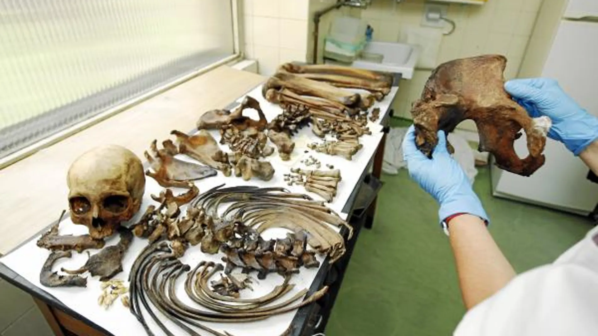 Los restos óseos de la imagen pertenecen a un cuerpo que llevaba diez años enterrado