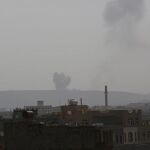 Al menos 44 muertos y 180 heridos en bombardeos de la coalición árabe en Saná
