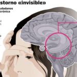 Dolor de cabeza: el calvario de más de 6 millones de españoles