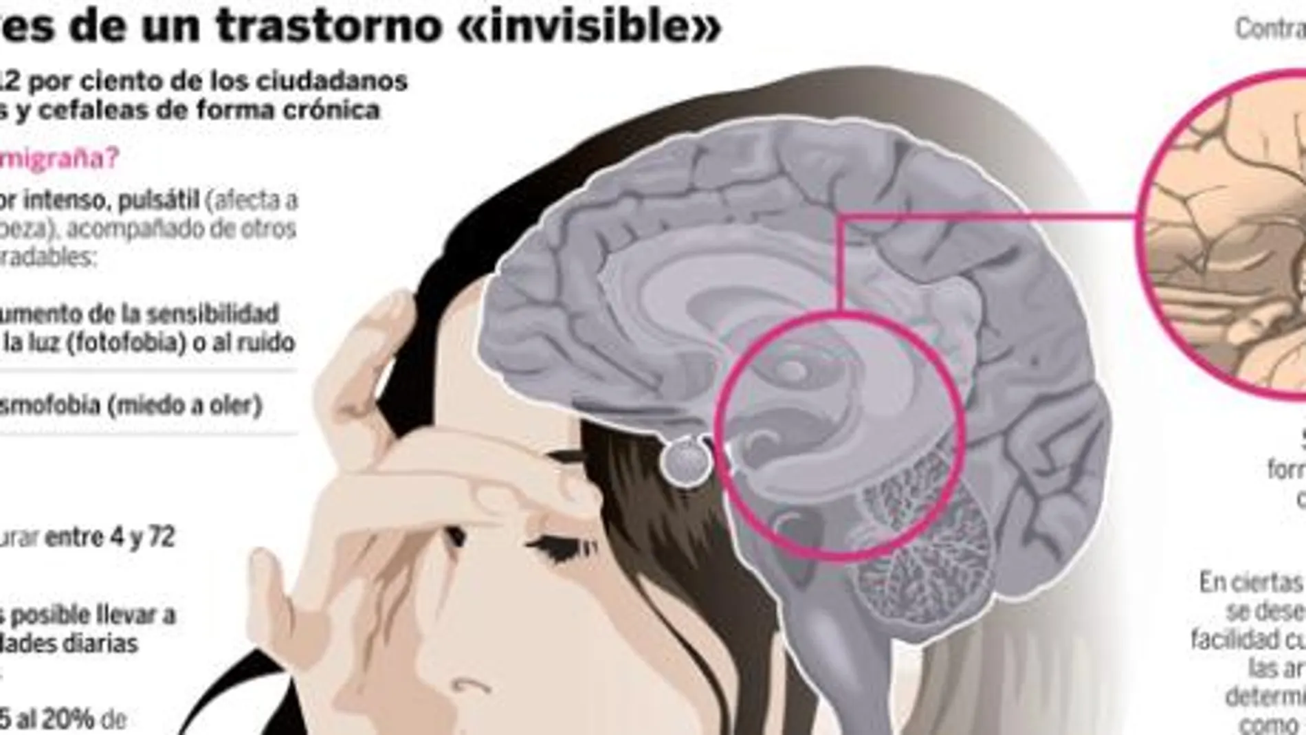Dolor de cabeza: el calvario de más de 6 millones de españoles