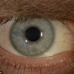 Autopsias de víctimas de covid-19 detectan el virus en sus ojos