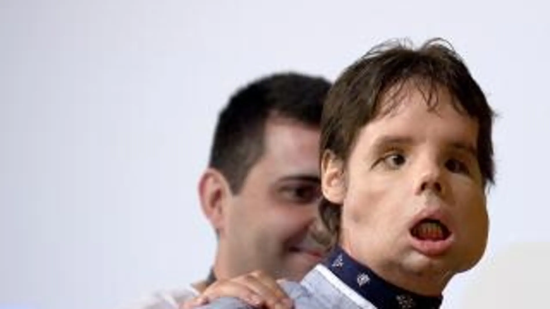 Primer trasplantado total de cara: «Me reconozco ante el espejo»