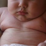 España supera ya en obesidad infantil a Estados Unidos