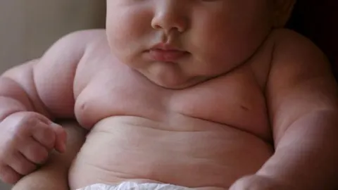 España supera ya en obesidad infantil a Estados Unidos
