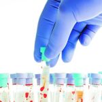 Biotecnología contra las enfermedades graves