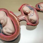 Y si el feto no es un ser humano, ¿entonces qué es?