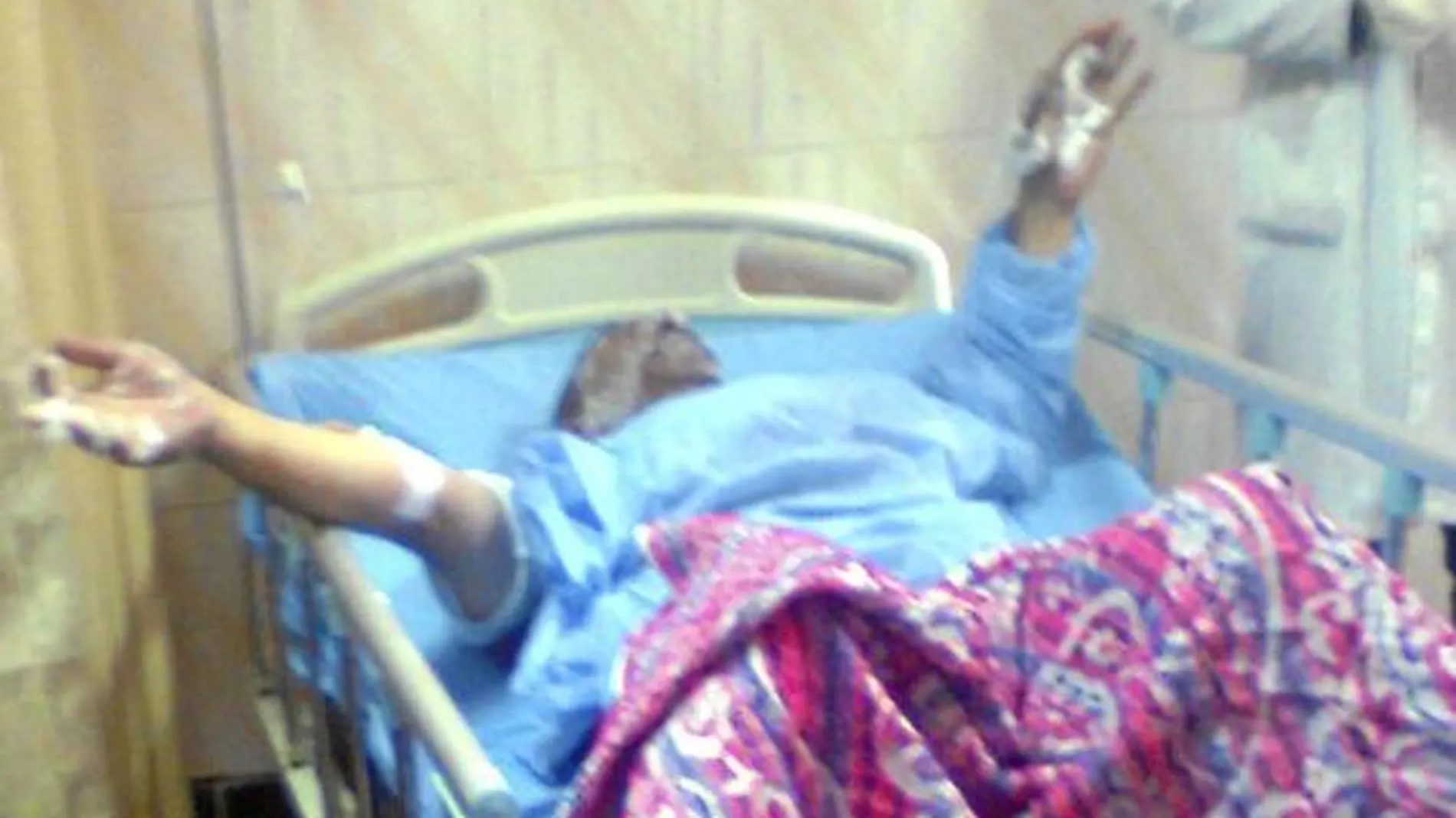 Abdo Abdelmanam, en el hospital donde se recupera de las quemaduras en manos y cara
