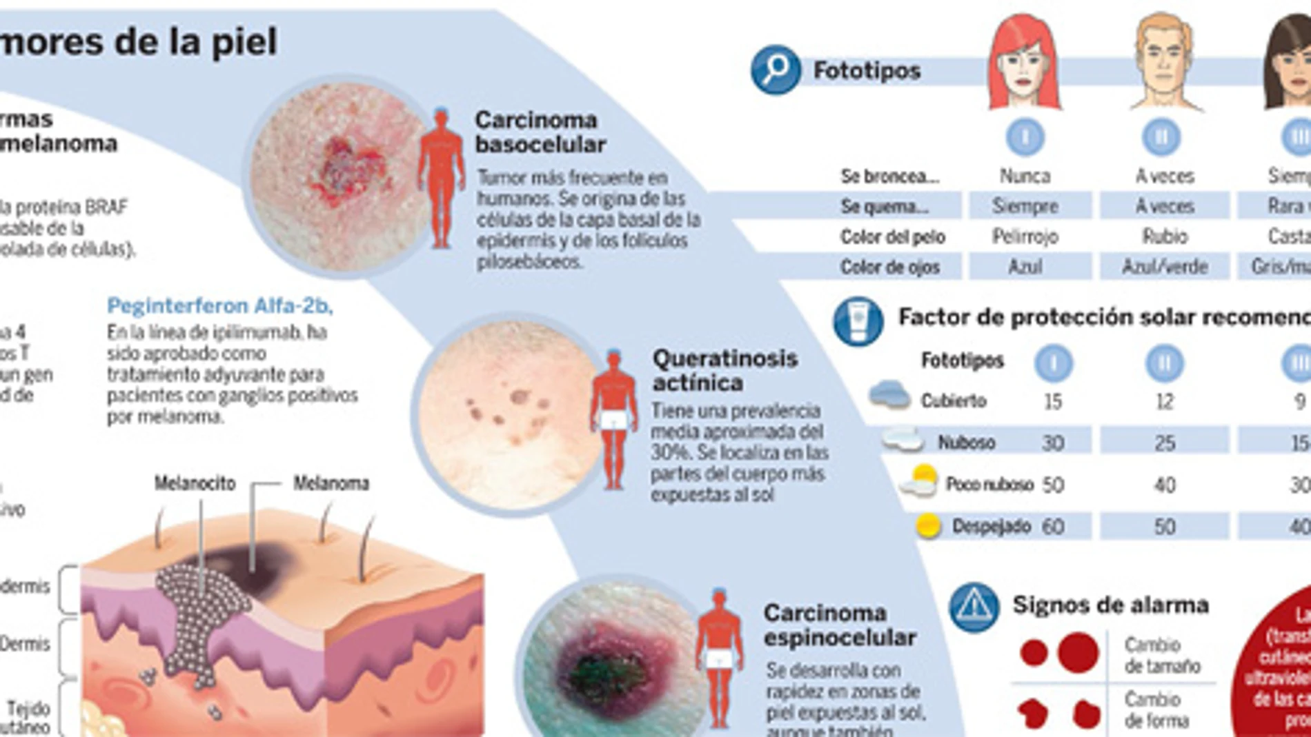 Nuevas armas contra el melanoma