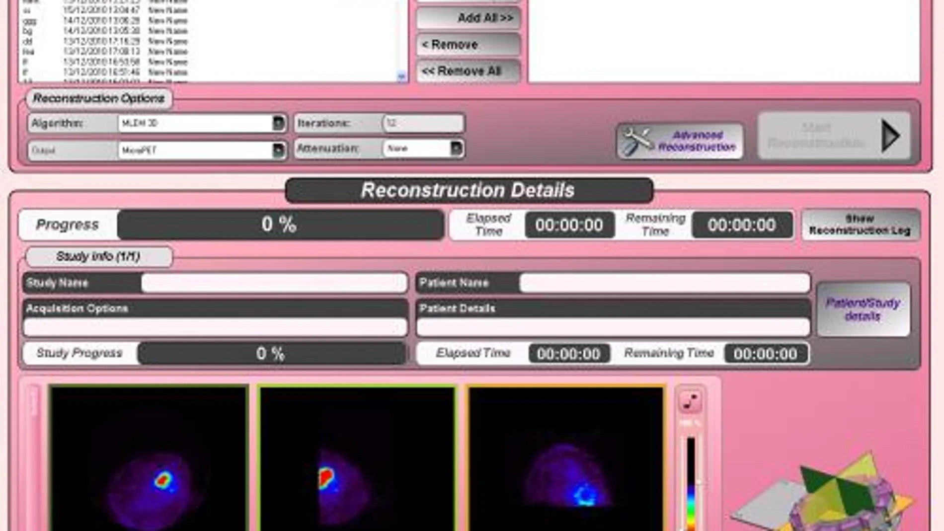 El CISC diseña un mamógrafo que mejora la detección del cáncer