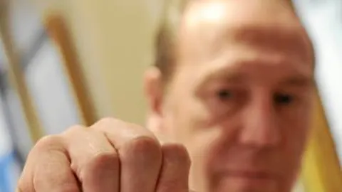Una ITV sólo para prótesis