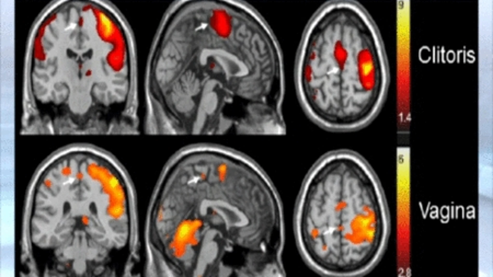 La investigación de la Universidad Charité sugiere que existe un vínculo entre el grosor de la región genital del cerebro y la frecuencia de las relaciones sexuales | Fotografía de archivo