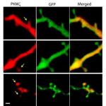 La molécula de PKM zeta se sobreexpresaba en algunos puntos de contacto de la neuronas