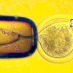 Imagen al microscopio de una inseminación artificial