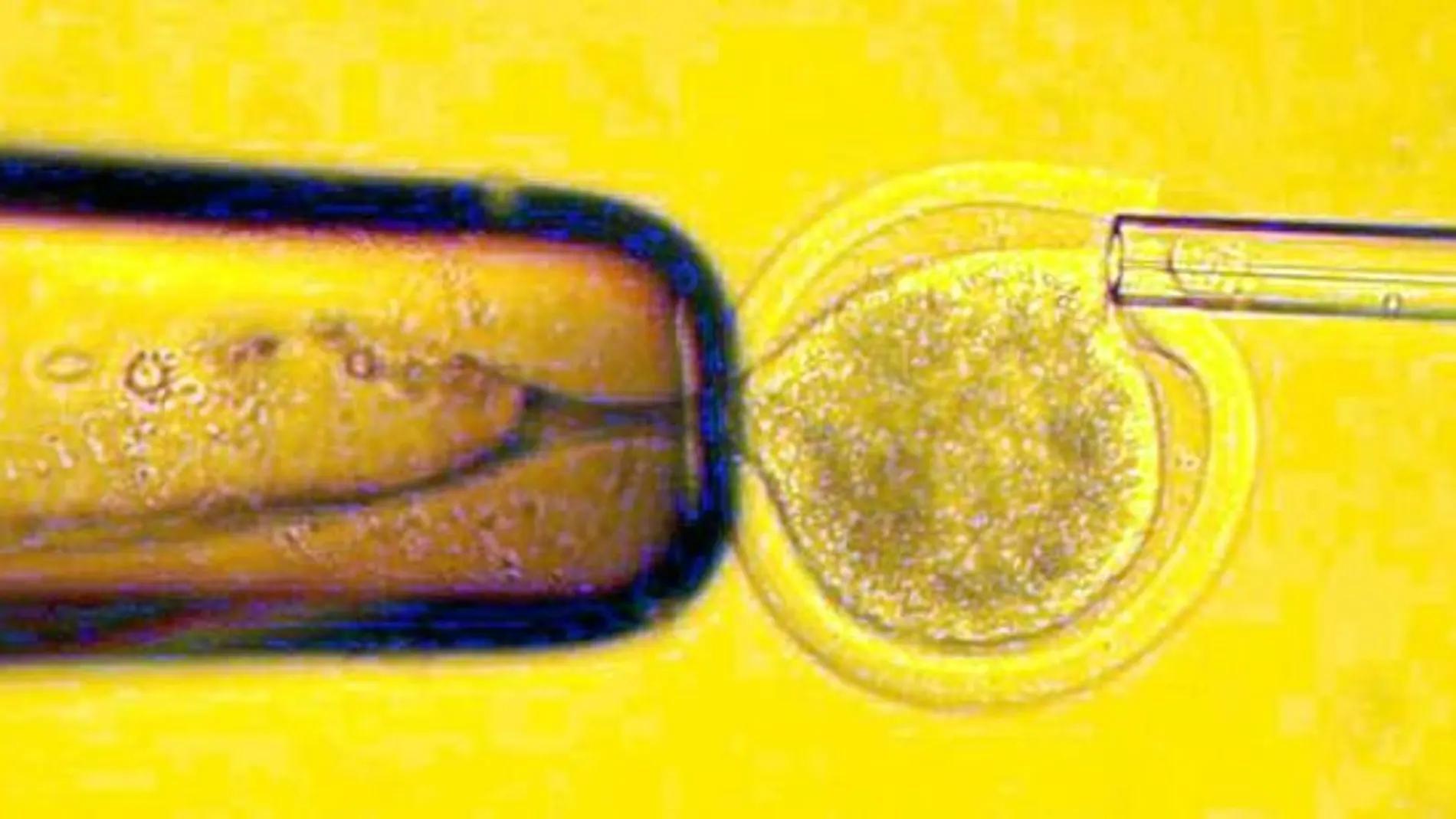 Imagen al microscopio de una inseminación artificial