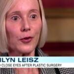 La mujer que se operó de los párpados en una clínica de estética, durante la entrevista con la ABC