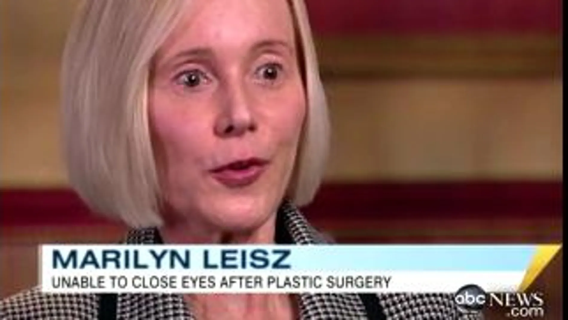 La mujer que se operó de los párpados en una clínica de estética, durante la entrevista con la ABC