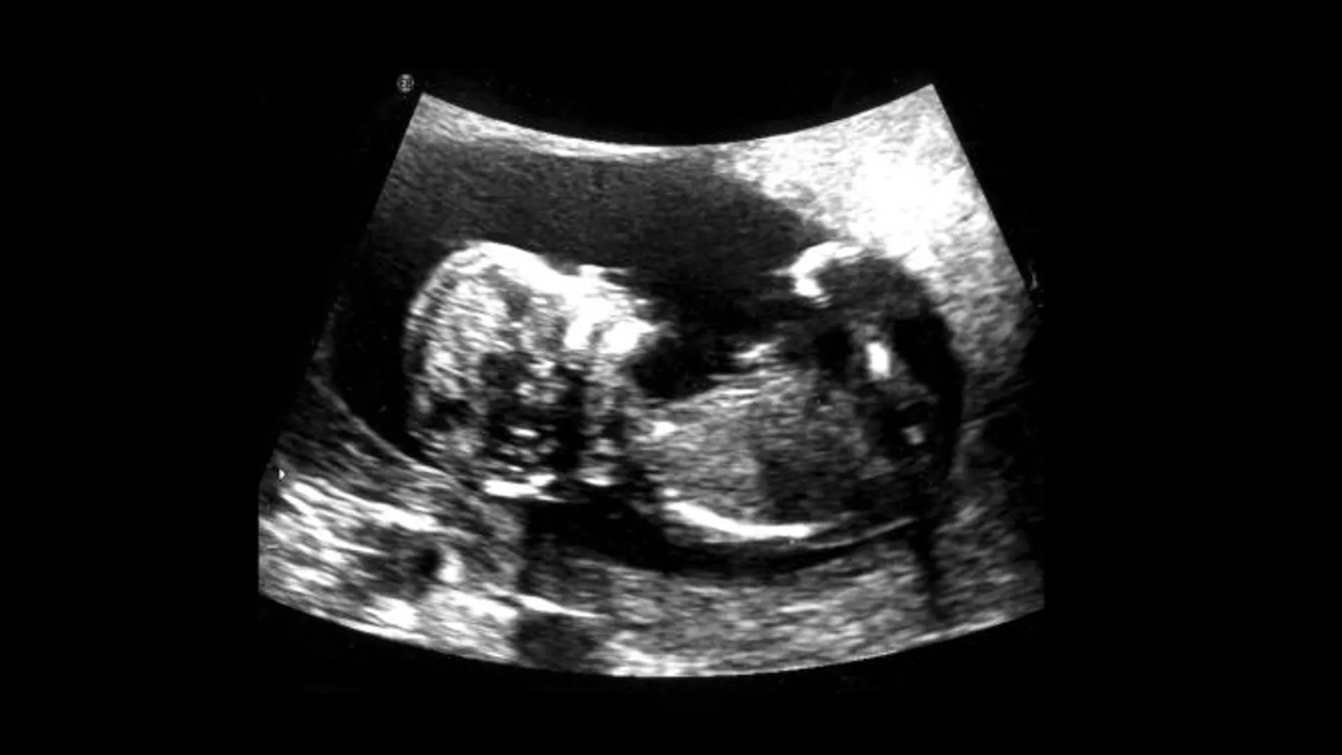Ecografía del bebe «X» colgada en la web de la artista