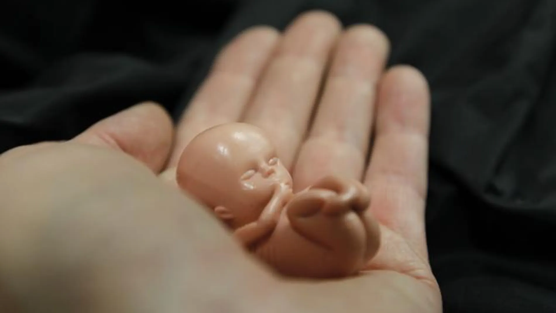 Baleares seguirá cobrando por adelantado los abortos