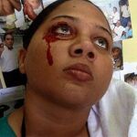 La joven que llora sangre (Foto: listindiario.com)