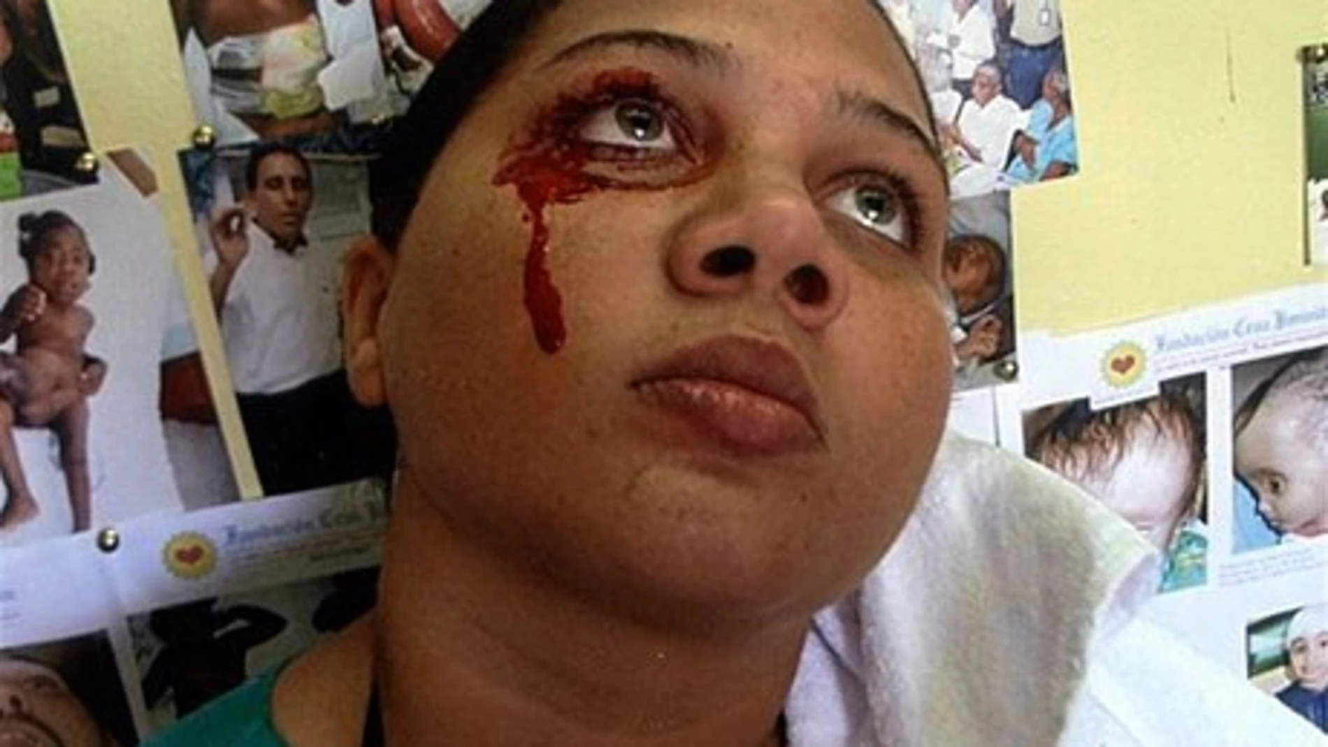 La joven que llora sangre (Foto: listindiario.com)