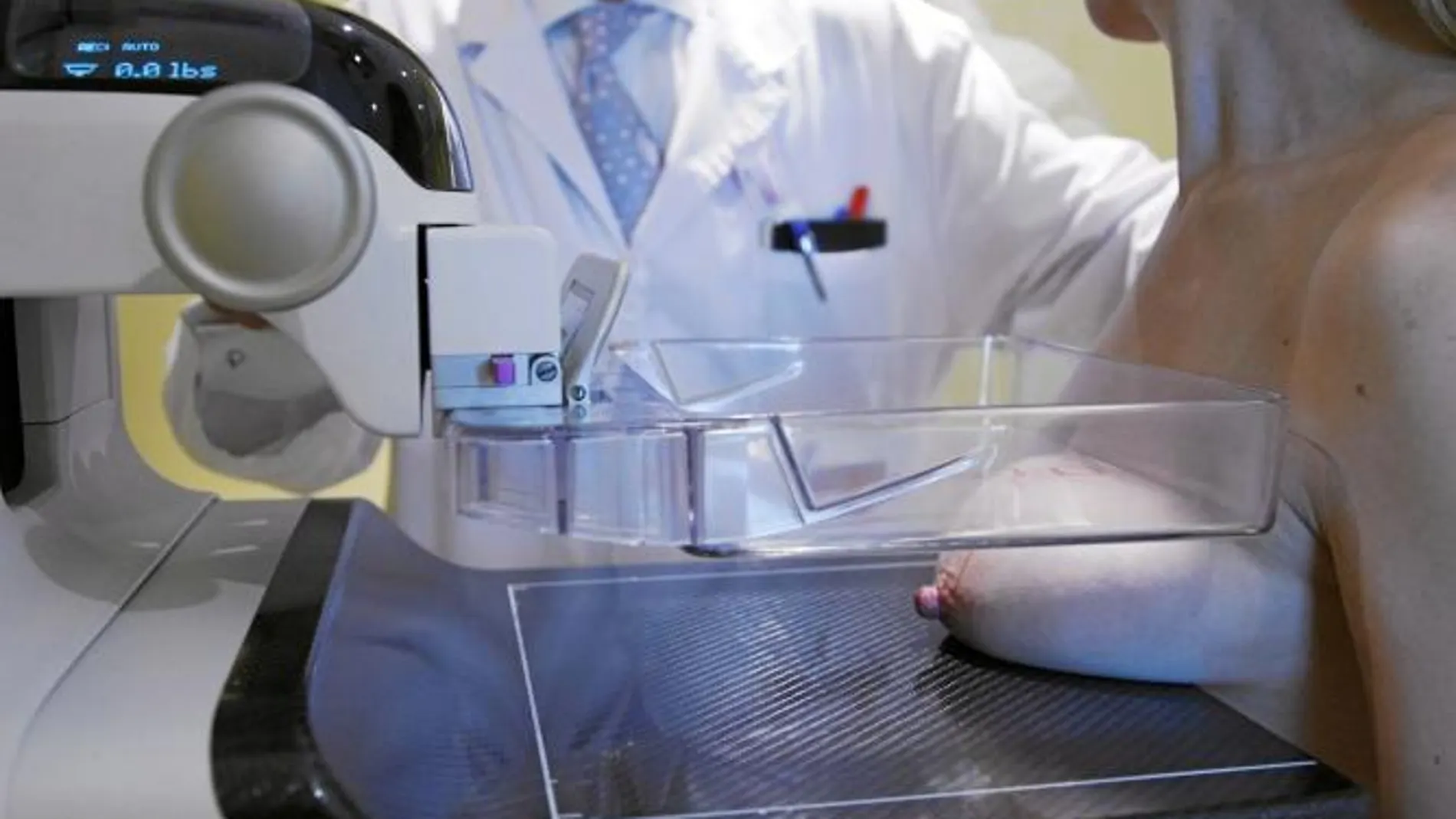 Una mamografía a tiempo puede salvar del cáncer a ocho de cada diez mujeres