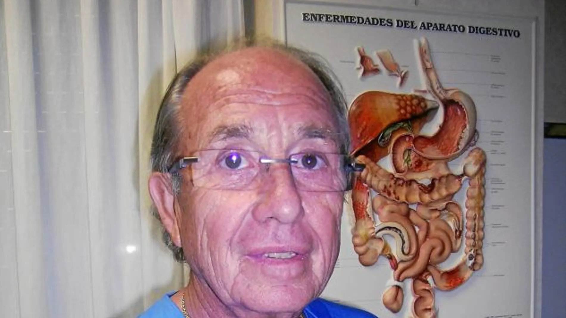Nuevo sistema de detección precoz del cáncer de colon