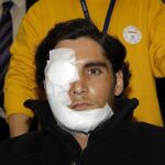 Ángel Teruel sigue con «problemas en el nervio facial»
