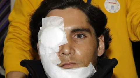 Ángel Teruel sigue con «problemas en el nervio facial»