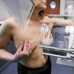 Sanidad realizó 68710 pruebas de detección precoz de cáncer en 2011