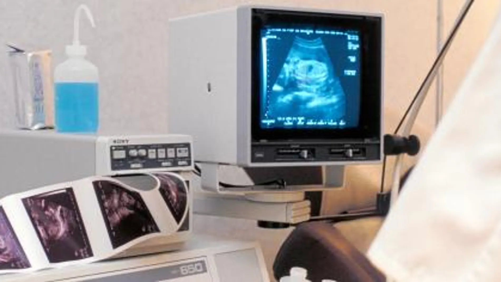 Sanidad sólo garantiza la gratuidad de los abortos por «motivos médicos»