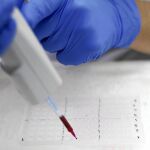 Los investigadores de élite se unen para curar el sida