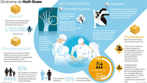 Pulgares con tres falanges
