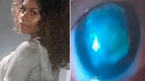 Miyako Aiko-Murray compartió su extraña enfermedad en las redes / Facebook
