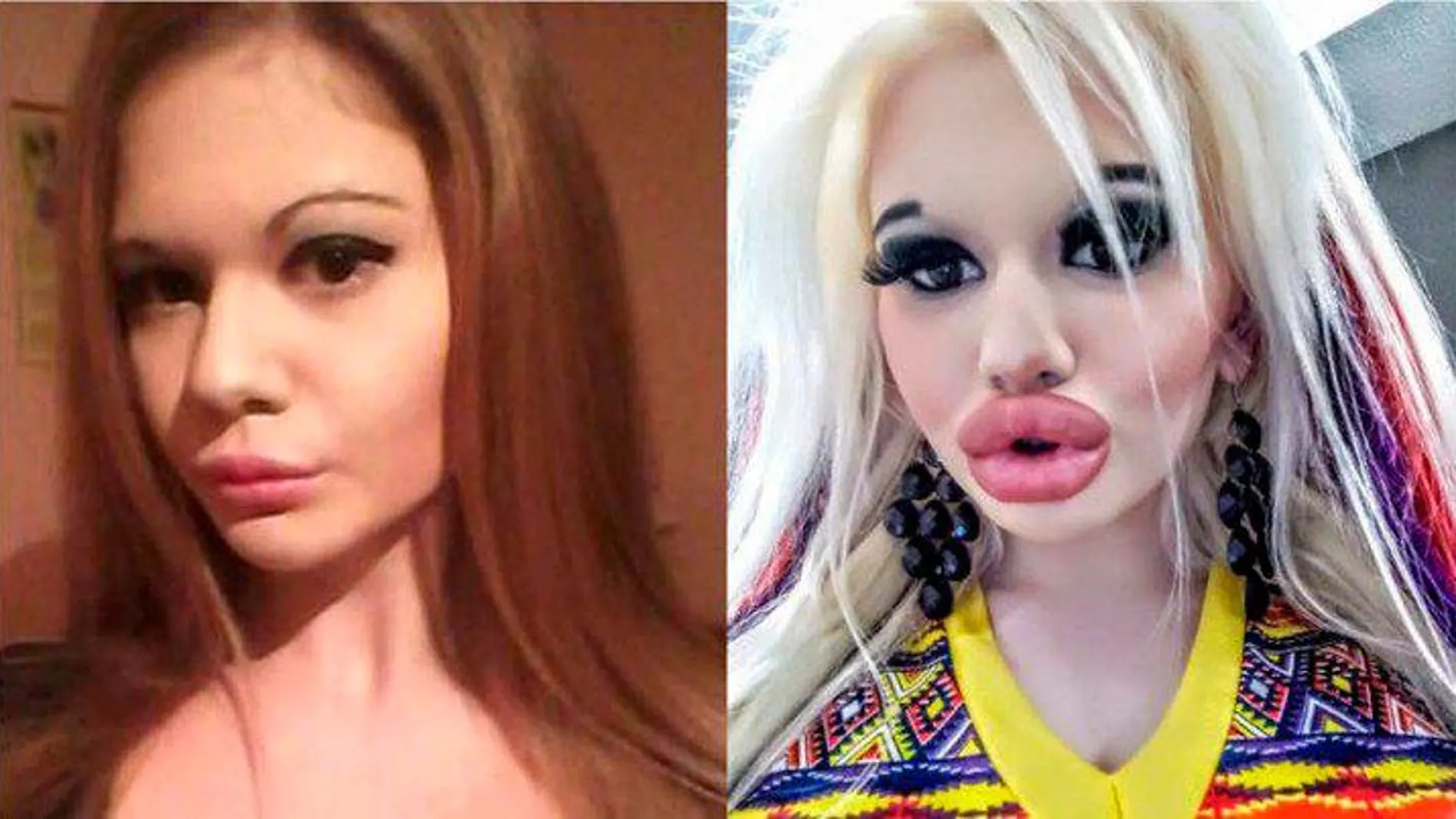 El antes y el después de Andrea Emilova tras someterse a 15 operaciones / Instagram