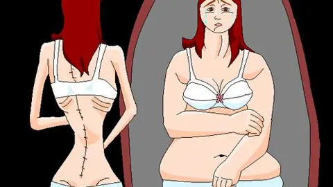 Los adolescentes, los más vulnerables a trastornos alimenticios