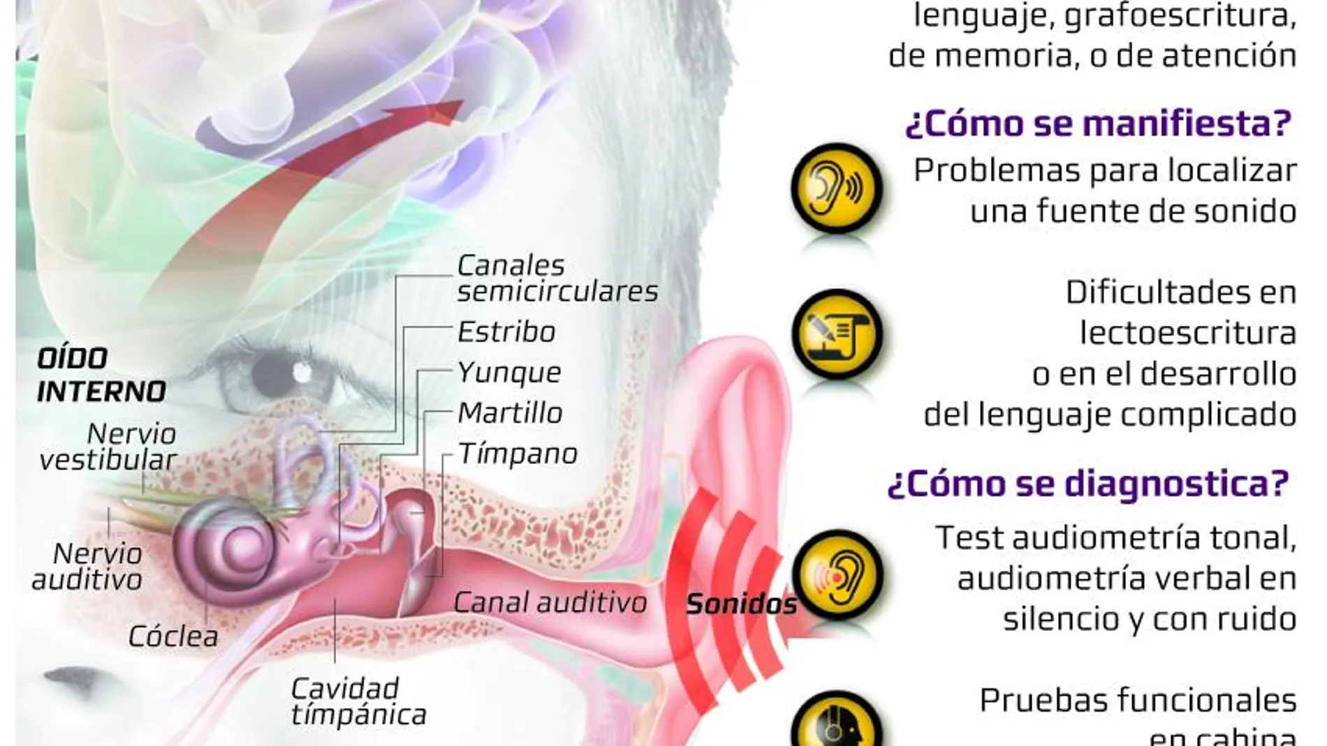 El desorden del procedimiento auditivo central es un problema de integración de la señal sonora en el cerebro.