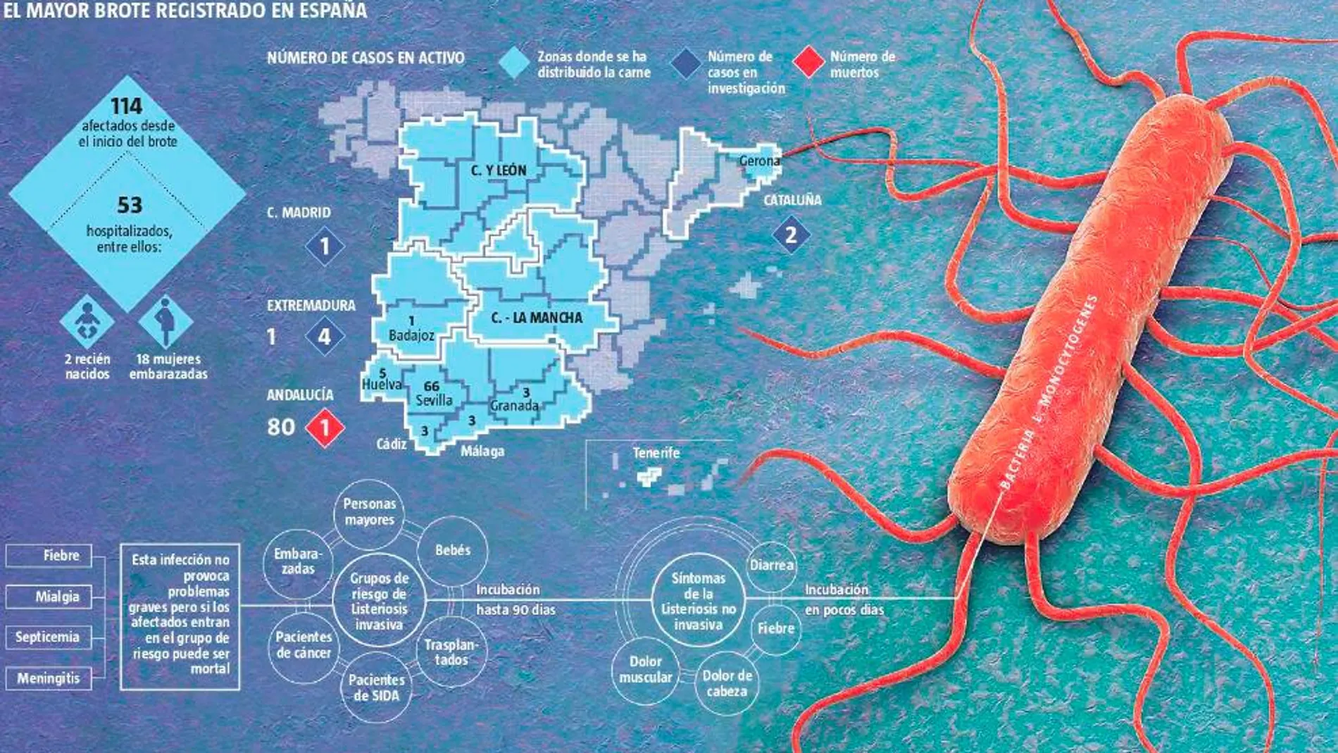 Listeriosis, un patógeno común en el entorno