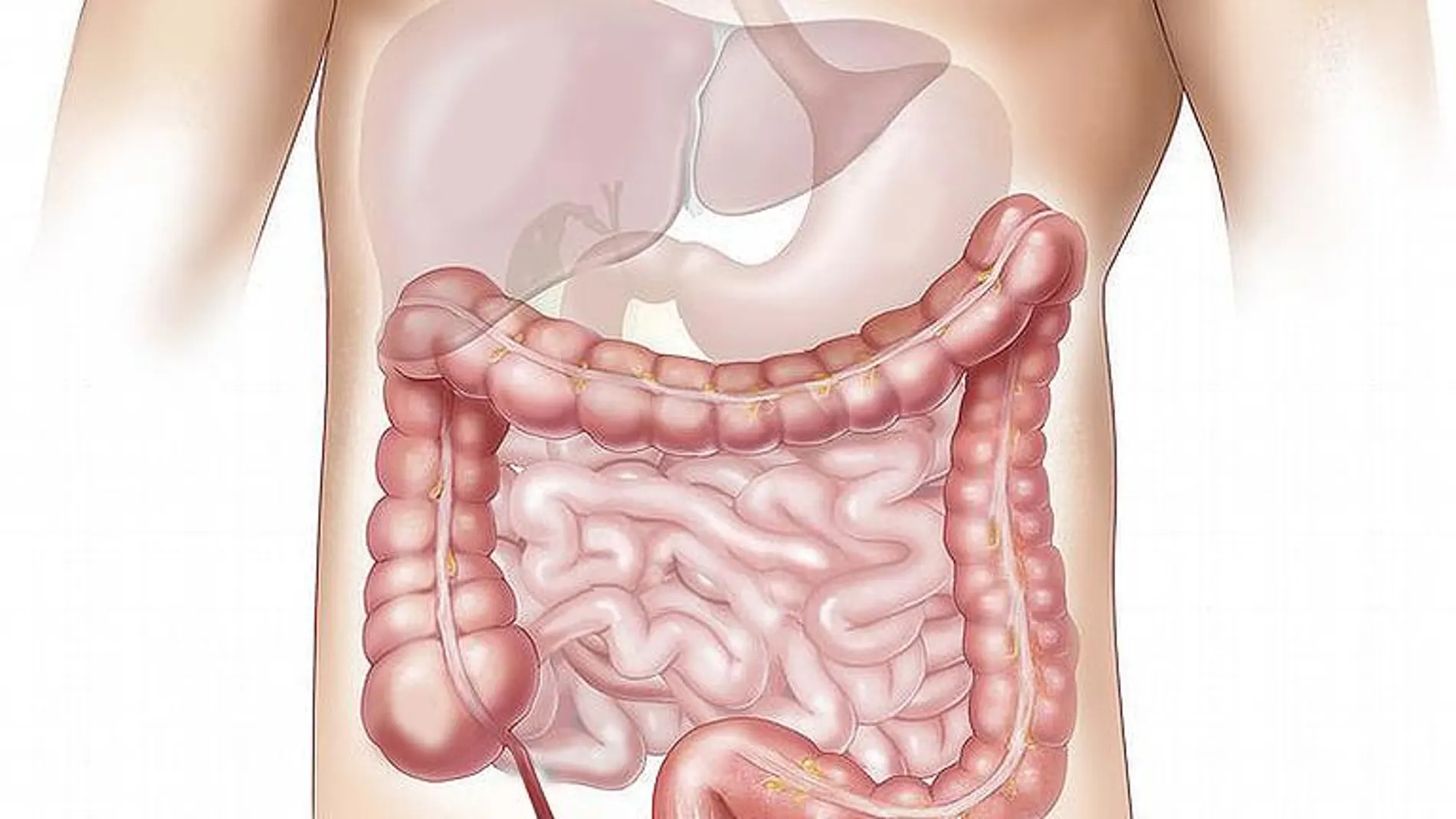 La dieta, el tema que más falsas creencias genera en los pacientes con Síndrome del Intestino Irritable