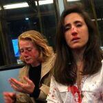 Una pareja de lesbianas sufrieron una agresión homofóbica en un autobús de Londres