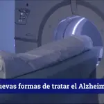 El nuevo tratamiento contra el Alzheimer: ultrasonido dirigido