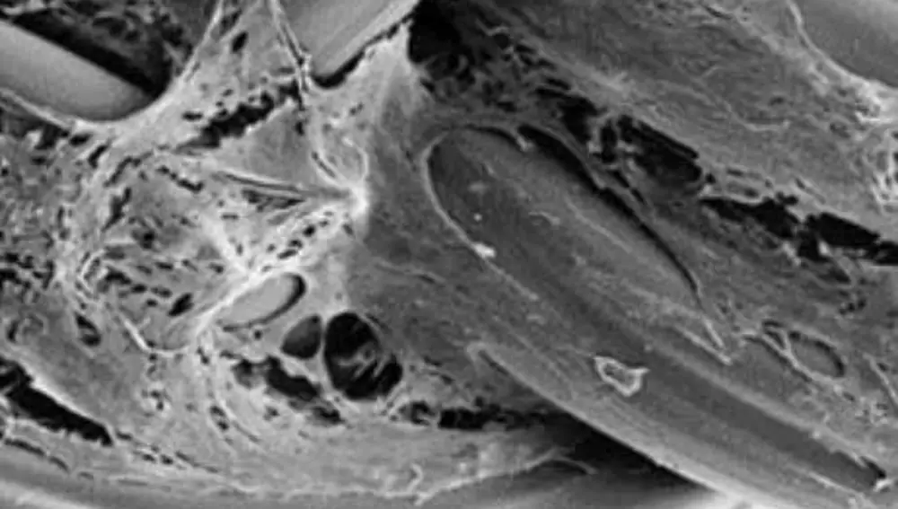 Crecimiento de células madre (células mesenquimales) sobre el trenzado de hijuelas de gusano.UNIVERSIDAD POLITÉCNICA DE MADRI10/12/2019