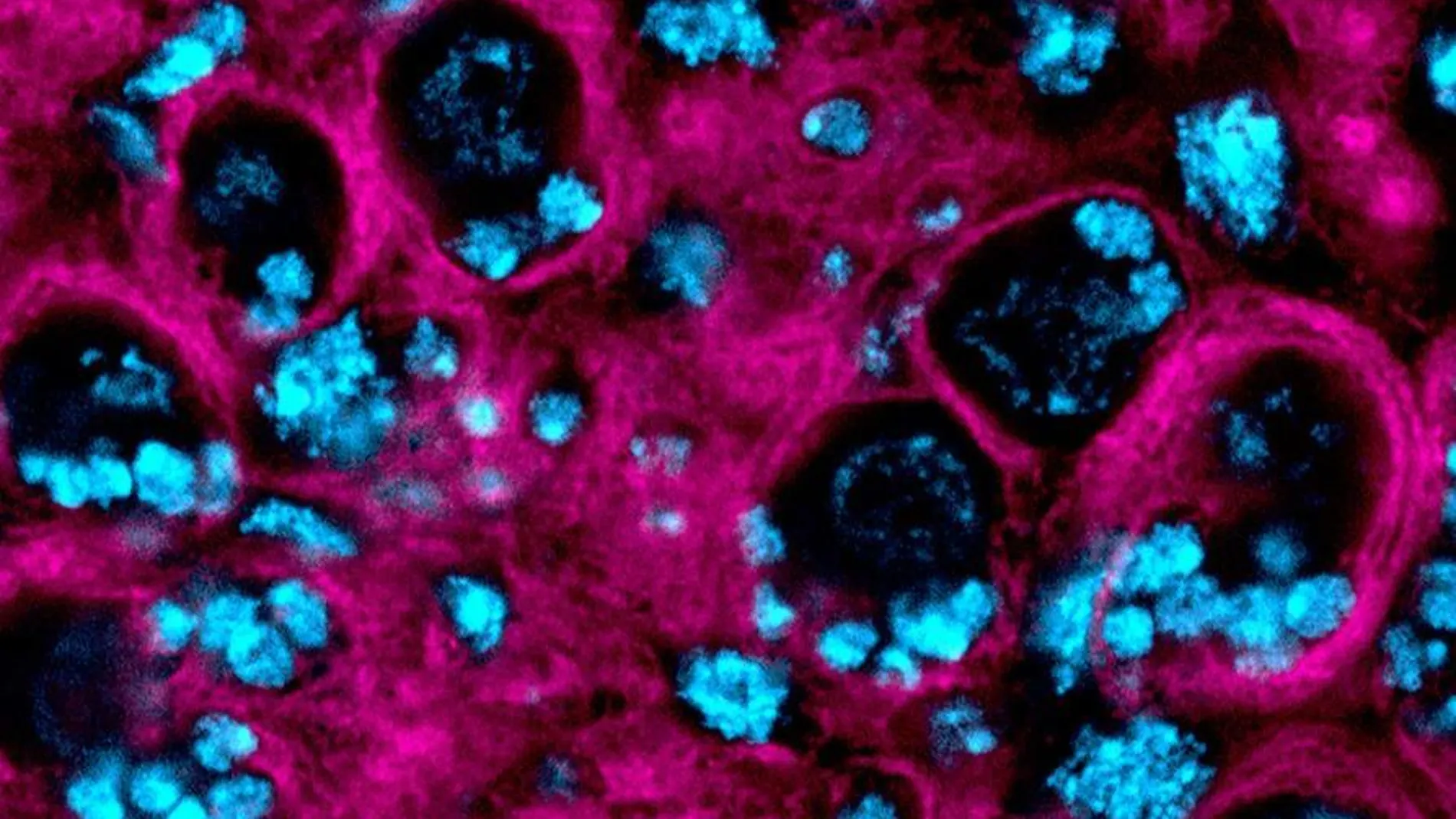 Membranas de las células del glioblastoma (magenta) rodean a las neuronas (azul). Marta Portela CSIC