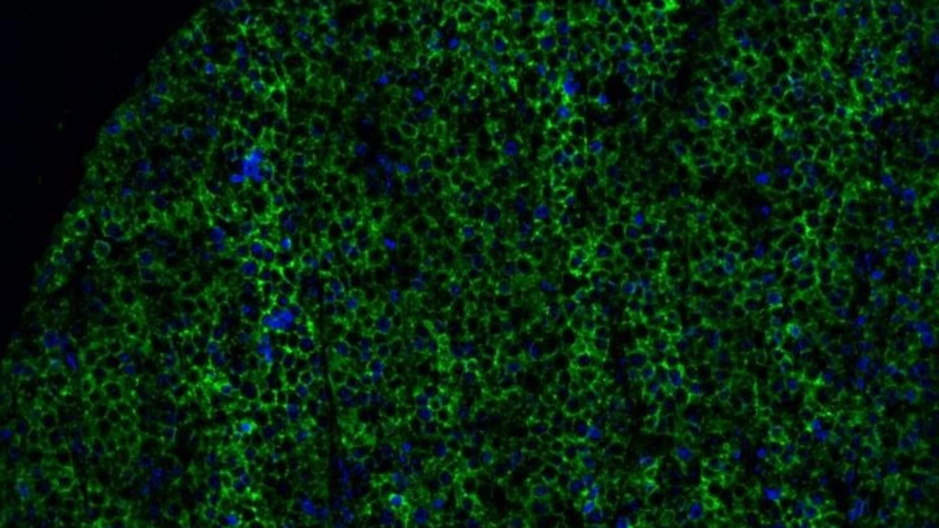Investigadores descifran una nueva forma en que las células inmunes detectan infecciones y cánceres