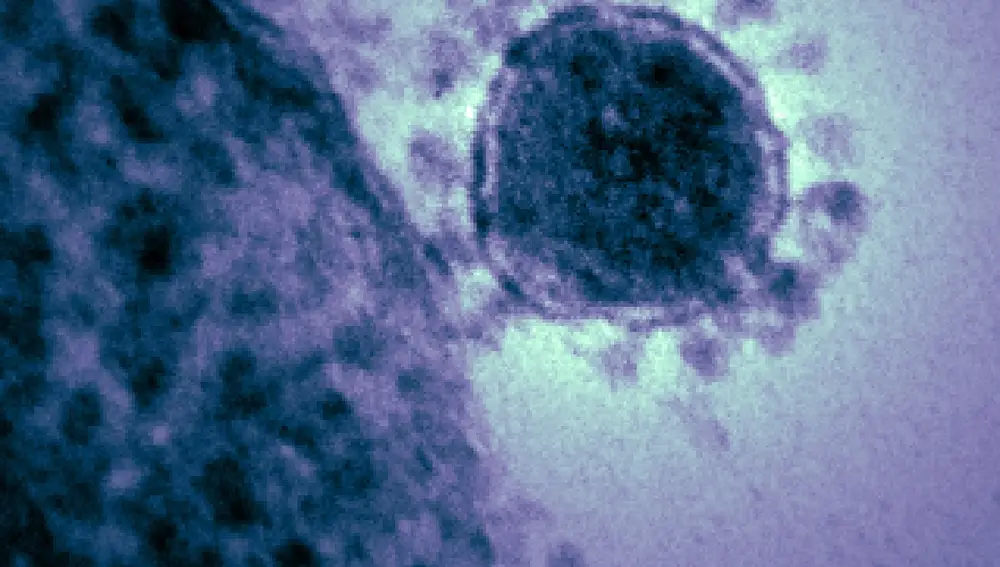 Imagen de archivo de un coronavirusINSTITUTO NACIONAL DE SALUD DE E  (Foto de ARCHIVO)19/11/2012