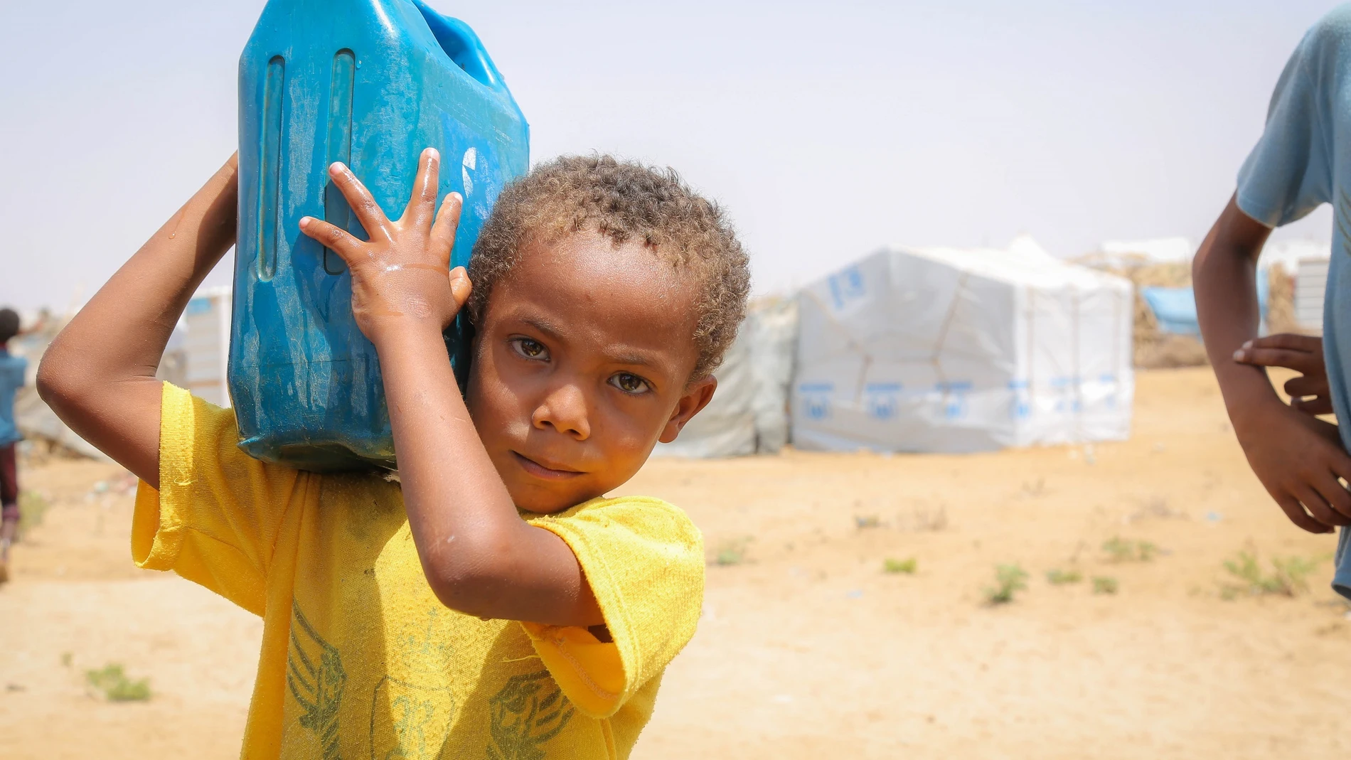 Igualdad destina 300.000 euros a Yemen por la grave emergencia humanitaria que vive el país a causa de la guerra