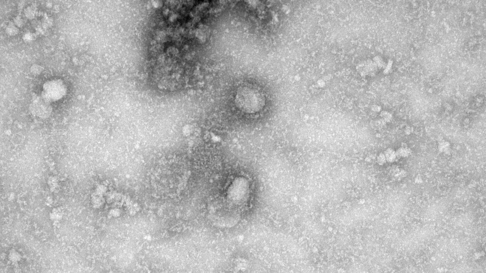 Imagen microscópica de la primera cepa del virus