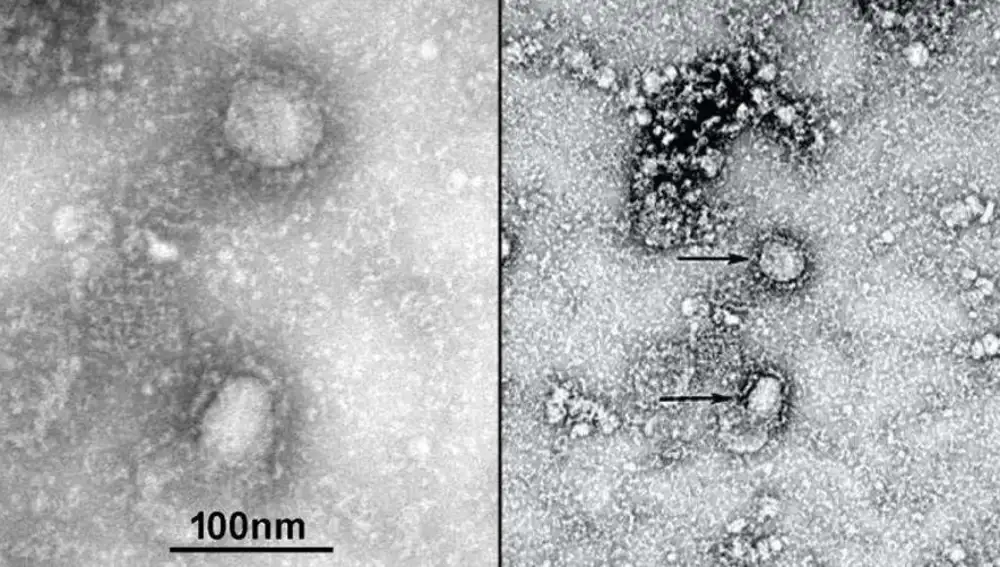 Primera imagen de microscopia electrónica del nuevo coronavirus, compartida por las autoridades chinas.