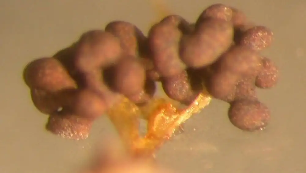 Esporangio de Physarum polycephalum