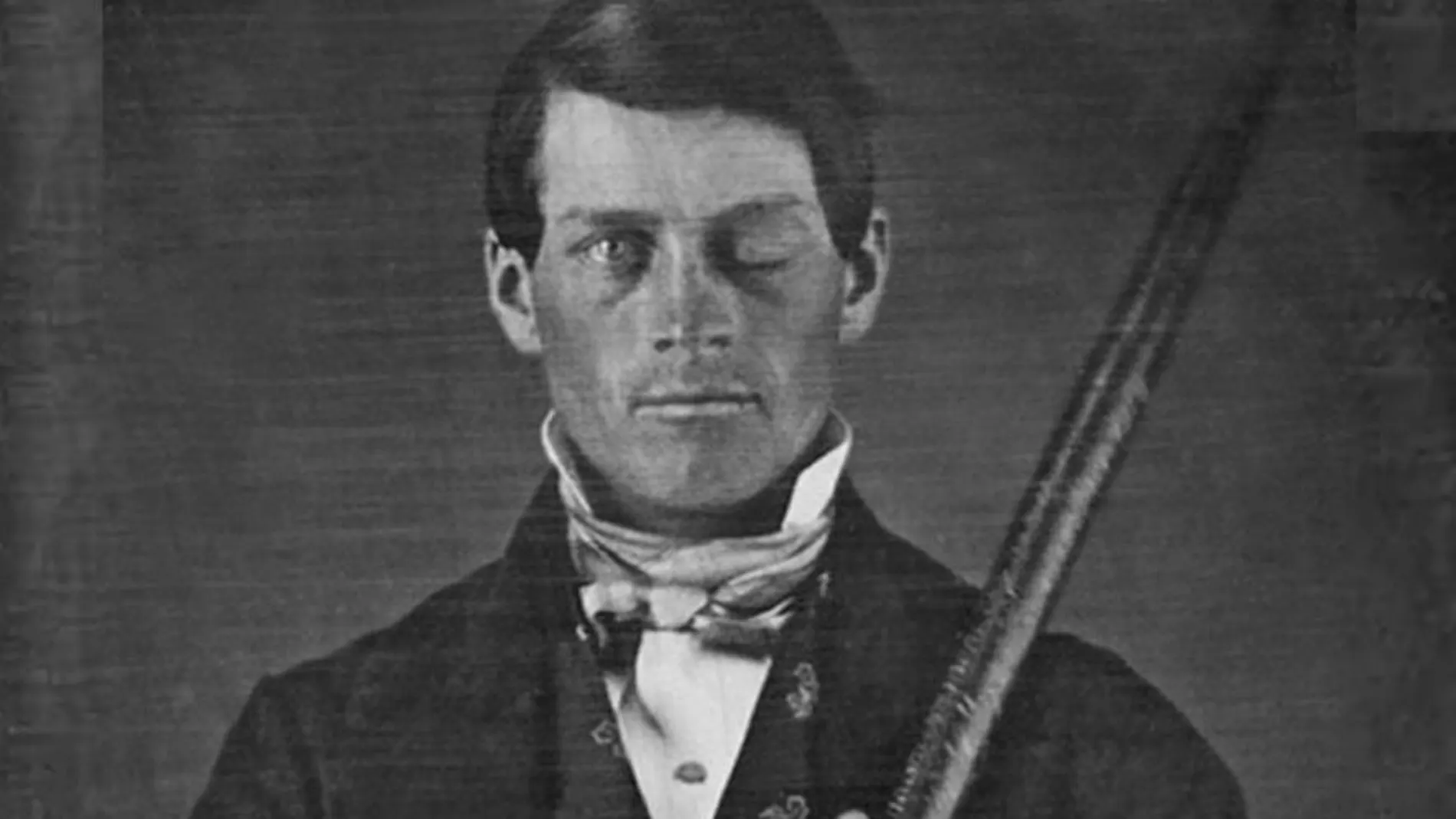 Cuando este daguerrotipo se descubrió fue llamada “Ballenero”, asumiendo que se trataba de un marino con su arpón y el ojo dañado por las vicisitudes del océano. Sin embargo, en 2010 se descubrió que era Phineas Gage, sosteniendo la barra que viajó a través de su cráneo.