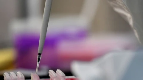 Un proyecto de investigación de la Universidad Miguel Hernández (UMH) de Elche pretende hallar e identificar compuestos bioactivos con potencial terapéutico en las secreciones mucosas de la piel de los peces para tratar infecciones y procesos cancerosos